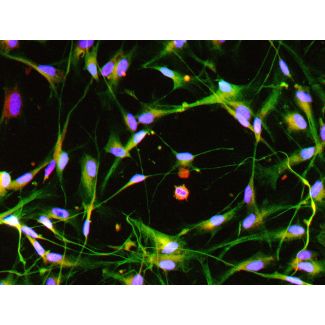 Human Pluripotent Stem Cell derived-Schwann Cells, immunostained for GFAP (red) and S100b (green) 200X