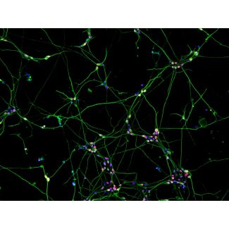 Human Pluripotent Stem Cell derived-Sensory Neurons (HPSC-SN) - immunostained for Brn3a (red) and Tubb3 (green) 100X
