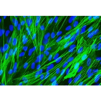 Human Pulmonary Artery Smooth Muscle Cells [HPASMC] - Immunostaining for α-SMA, 400x.
