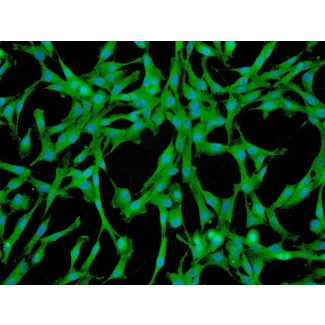Human Pulmonary Mesenchymal Stem Cells (HPMSC) - Immunostaining for CD73, 200x.
