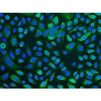 Human Tracheal Epithelial Cells (HTEpiC) - Immunostaining for CK-18, 100x.
