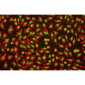 Human_Umbilical_Vein_Endothelial_Cells (HUVEC) – Immunofluorescence for vWF (Sigma-Aldrich Cat.#F3520), 200x.
