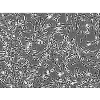 Mouse Astrocytes from CD1 (MA) - Phase contrast, 100x.
