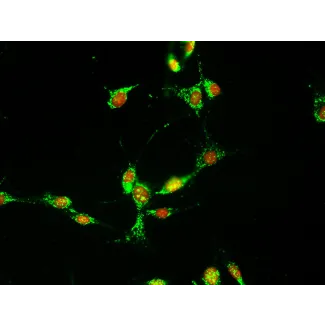 Mouse Dermal Fibroblasts (MDF) – Immunostaining for Fibronectin, 400x.

