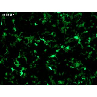 GFP expression in HEK293T cells transfected with the NF-kB GFP Reporter Vector after pathway activation (100x)
