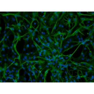 Rat Astrocytes-spinal cord (RA-sc)-Immunostaining for GFAP, 200X