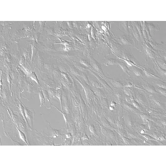 Rat Hepatic Stellate Cells-adult (RHSteC-a)-Relief contrast, 200x.
