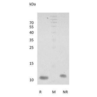 Recombinant Human NRG-1 (EGF-like domain) Beta 2：重组人NRG-1（EGF样结构域）Beta 2