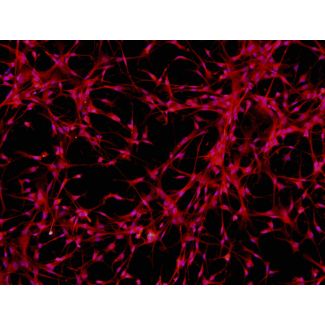 人多能干细胞衍生星形胶质细胞（H9-A）- GFAP免疫染色，200x。