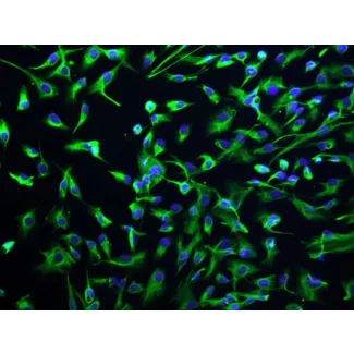 人肝内胆管上皮细胞（HIBEpiC）- CK-18 免疫染色（Sigma-Aldrich，产品编号 #C1399），200×