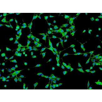 人胆囊成纤维细胞（HGBF）- 纤维连接蛋白（Fibronectin）免疫染色，200×
