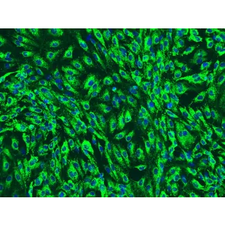 人胰腺微血管内皮细胞（HPaMEC）- vWF 免疫染色（Sigma-Aldrich，产品编号 #F3520），200×

