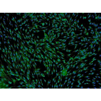 人脂肪间充质干细胞（HMSC-ad）—— CD73 免疫染色，100×。