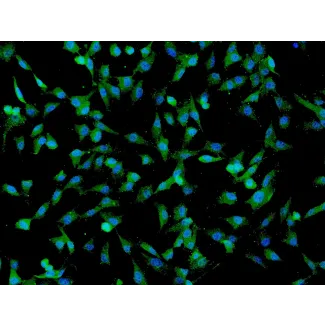 人脐带间充质干细胞（HUMSC）—— CD73 免疫染色，200×。
