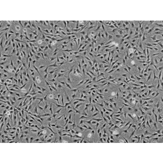 人角膜基质细胞（HK）- 相差显微镜，100×