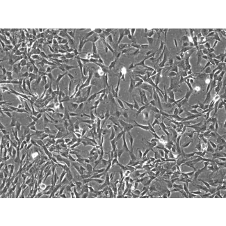 兔星形胶质细胞（RabA）— 相差显微镜图像，100×倍率。
