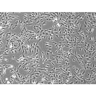 兔皮肤成纤维细胞（RabDF）— 相差显微镜图像，100×倍率。

