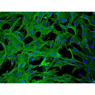兔肝星状细胞（RabHSteC）— α-平滑肌肌动蛋白（α-SMA）免疫染色，200×倍率。