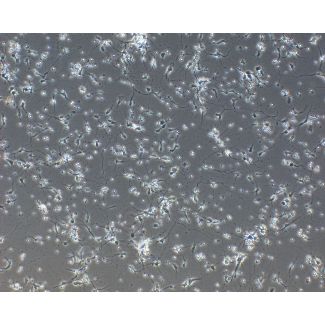 大鼠前脑神经元（RN-fb）—相差显微镜，100倍