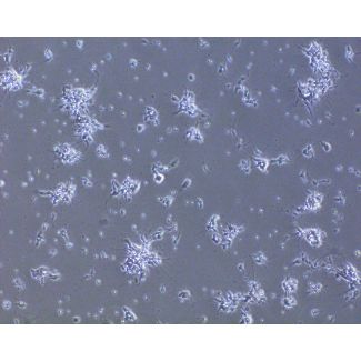 大鼠神经元 - 后脑（RN-hb）—相差显微镜，100倍