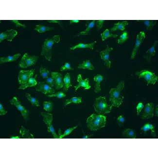 小鼠脾脏巨噬细胞（MSMa）——CD11b免疫染色，400×
