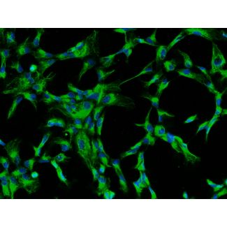 牛晶状体上皮细胞（BLEpiC）—CK-18 免疫染色，200X。
