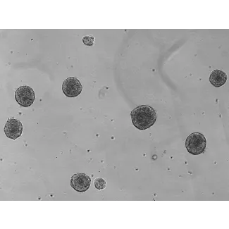 Day 5: Osteoblast and endothelial cells co-culture spheroids