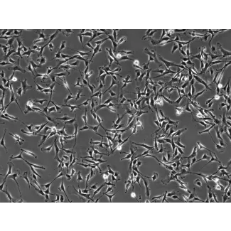 Bovine Dermal Fibroblasts (BDF)-Phase contrast, 100x