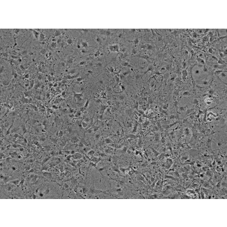 小鼠心肌细胞（MCF）- 相差显微镜，100×。