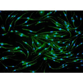 小鼠骨髓巨噬细胞（MMa-bm）- CD11b免疫染色，200倍放大。
