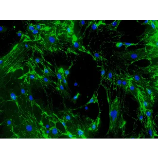 CD1 小鼠心脏成纤维细胞（MCF）- 纤维连接蛋白（Fibronectin）免疫染色，200×。
