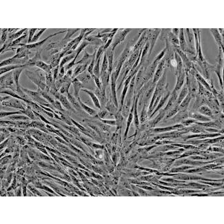 Dog Mesenchymal Stem Cells-adipose (DMSC-ad) - Phase contrast, 200x.
