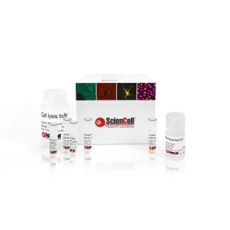 GeneQuery™ HLA-A*02 Screening Kit by qPCR