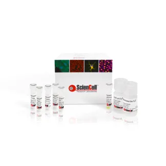 GeneQuery™ Human Biological Sex Determination qPCR Assay Kit (HSDQ)