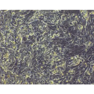 HPSC-derived Cardiomyocytes
