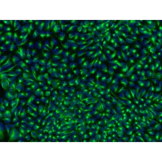 HPSC 来源的神经干细胞（H9-NSC）— Nestin 免疫染色，200 倍放大