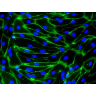 HiPSC-Derived Endothelial Cells (HiPSC-EC) -
Immunostaining for CD31, 200x
