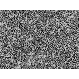 Horse Mesenchymal Stem Cells-adipose (HNSC-ad) - Phase Contrast 100X