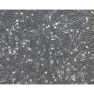 hPSC-Derived Endothelial Cells (hPSC-EC) - Phase contrast, 100x