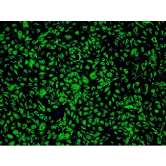 Human Adipose Microvascular Endothelial Cells (HAMEC) - Immunostaining for vWF, 100x.
