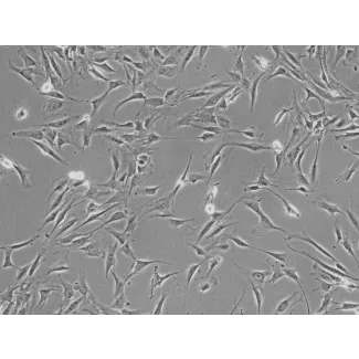 Human Adrenal Cortical Cells (HAdCC) - Phase contrast, 200x.
