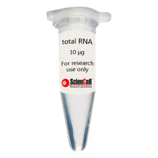 Human Brain Vascular Adventitial Fibroblast Total RNA