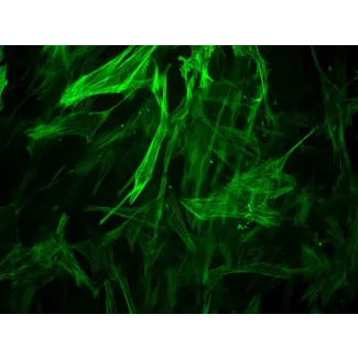 Human Brain Vascular Smooth Muscle Cells [HBVSMC] - Immunostaining for α-SMA, 400x.
