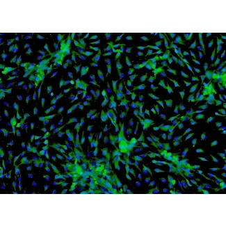 Human Cardiac Myocytes-adult (HCM-a) - Immunostaining for Sarcomeric α-Actinin, 100x.