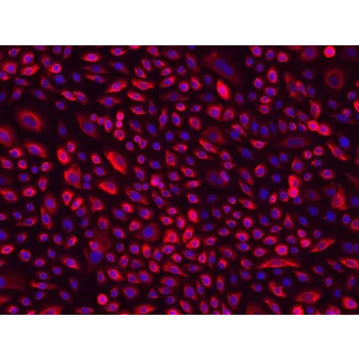 Human Cervical Epithelial Cells (HCerEpiC)-Immunostaining for CK-18, 200x.
