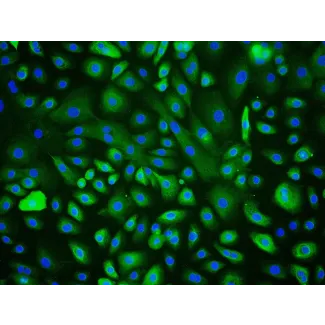 Human Corneal Epithelial Cells (HCEpiC) - Immunostaining for CK-18, 200x.
