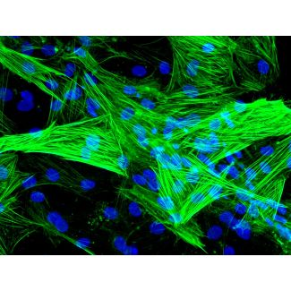 Human Coronary Artery Smooth Muscle Cells (HCASMC)-Immunostaining for α-SMA, 400x