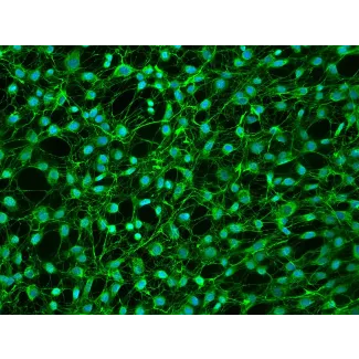 Human Dural Fibroblasts - Immunostaining for FN, 200X
