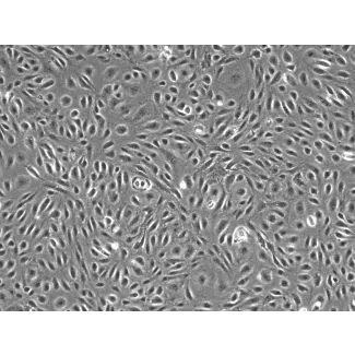 Human Dural Microvascular Endothelial Cells - Phase Contrast, 100X
