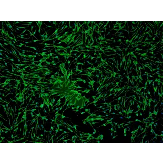 Human Epidermal Melanocytes-light (HEM-l) - Immunostaining for S100-β, 100x.
